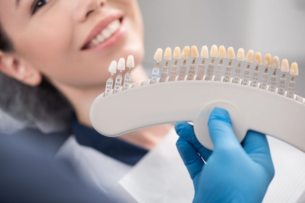 composite vs porcelain veneers which is better